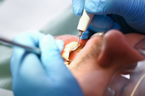 Best Mobile Emergency Dentist in Sweet Springs, MO