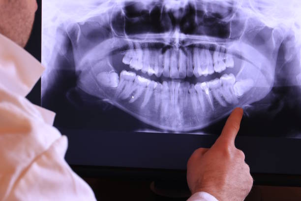 Best Pediatric Emergency Dentist in Sweet Springs, MO